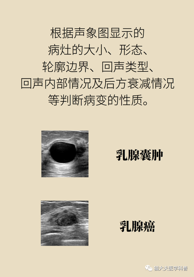 【天坛科普】钼靶和B超，检查乳腺选哪个？(图16)